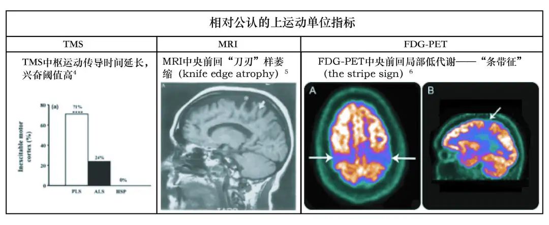 下肢运动神经元综合征可以治疗吗,怎么诊断得了运动神经元病