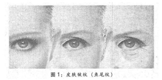 消除皱纹古方,去皱纹古方