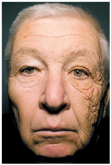 物理防晒(纳米VS非纳米颗粒)和化学防晒的优势劣势