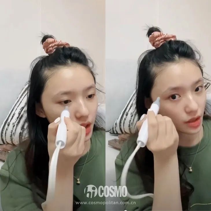 虞书欣澄清自己没有医美,虞书欣做什么医美