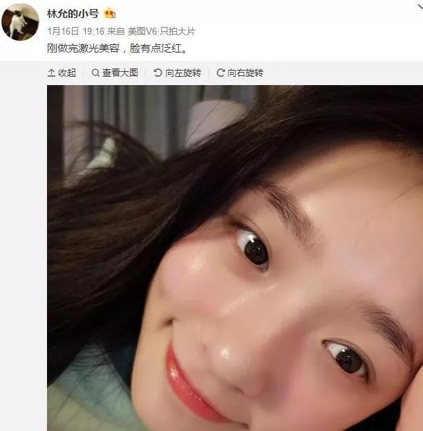 虞书欣澄清自己没有医美,虞书欣做什么医美