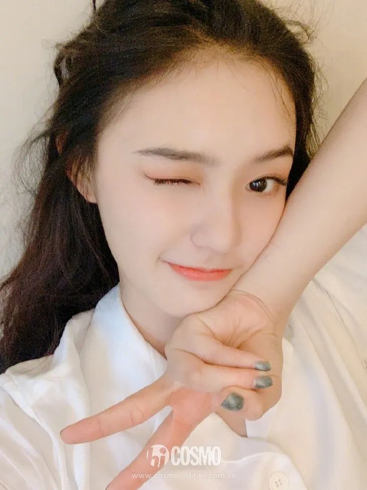 虞书欣澄清自己没有医美,虞书欣做什么医美