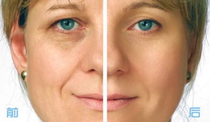 虞书欣澄清自己没有医美,虞书欣做什么医美