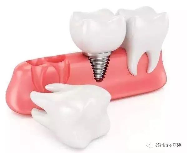 德州哪个医院种植牙比较好,德州齐河口腔医院种牙