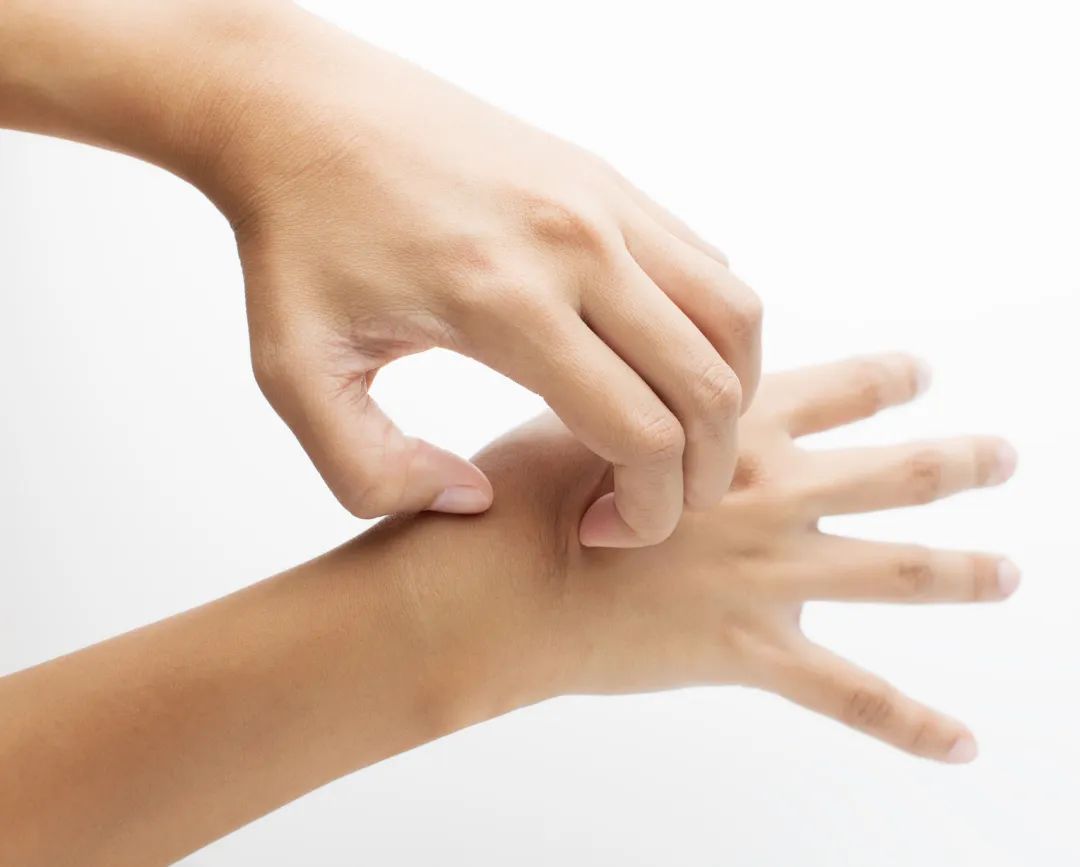 湿疹瘙痒最简单的自愈方法,老中医医治顽固性湿疹