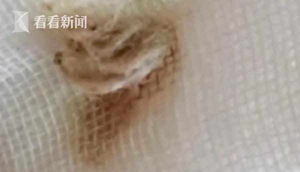 2岁女童医院检查早熟,2岁女童体下有臭味怎么回事