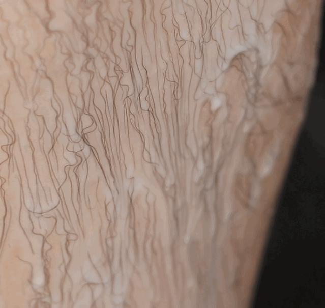 夏季脱毛必备,夏日必备脱毛告别尴尬