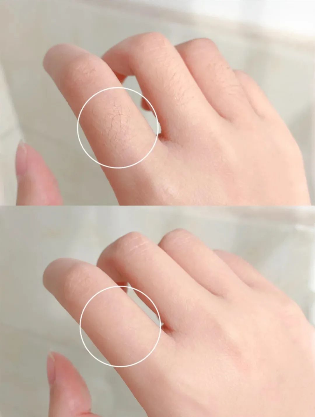 夏季脱毛必备,夏日必备脱毛告别尴尬