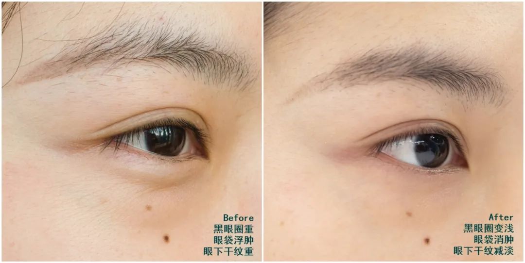 推广｜|长假还没来，我已经迫不及待穿上这条裙子了