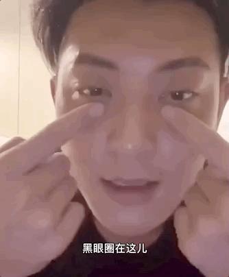 卧蚕和眼袋分不清有黑眼圈,已经分不清是卧蚕还是黑眼圈了