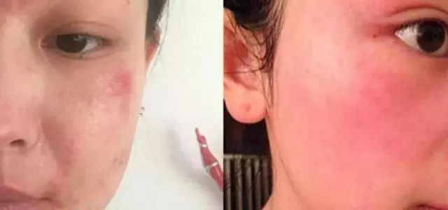 米皂美白,泰国大米皂美白效果