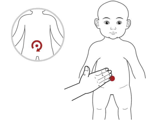 婴儿消化不良怎么办好,婴儿消化不良怎么办