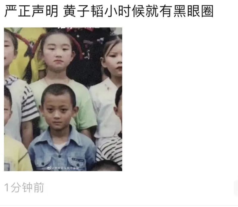 卧蚕和眼袋分不清有黑眼圈,已经分不清是卧蚕还是黑眼圈了