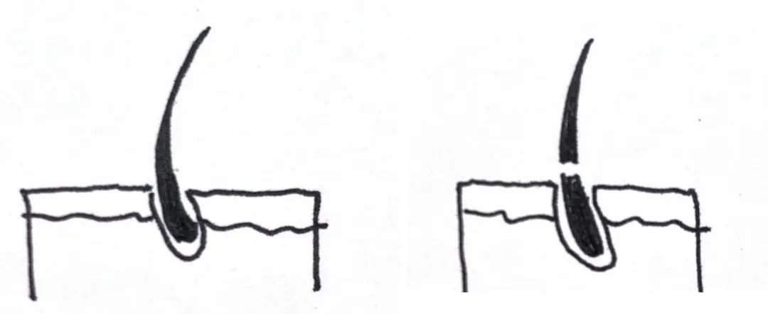 想当人间水蜜桃？人家才没你那么多毛