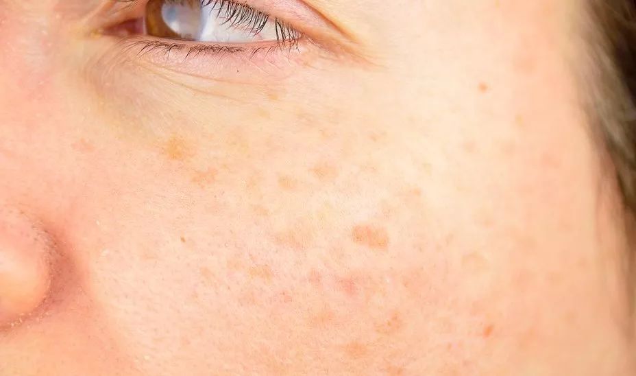 扔掉没用的捂脸布！360°“V”脸的它才是王道