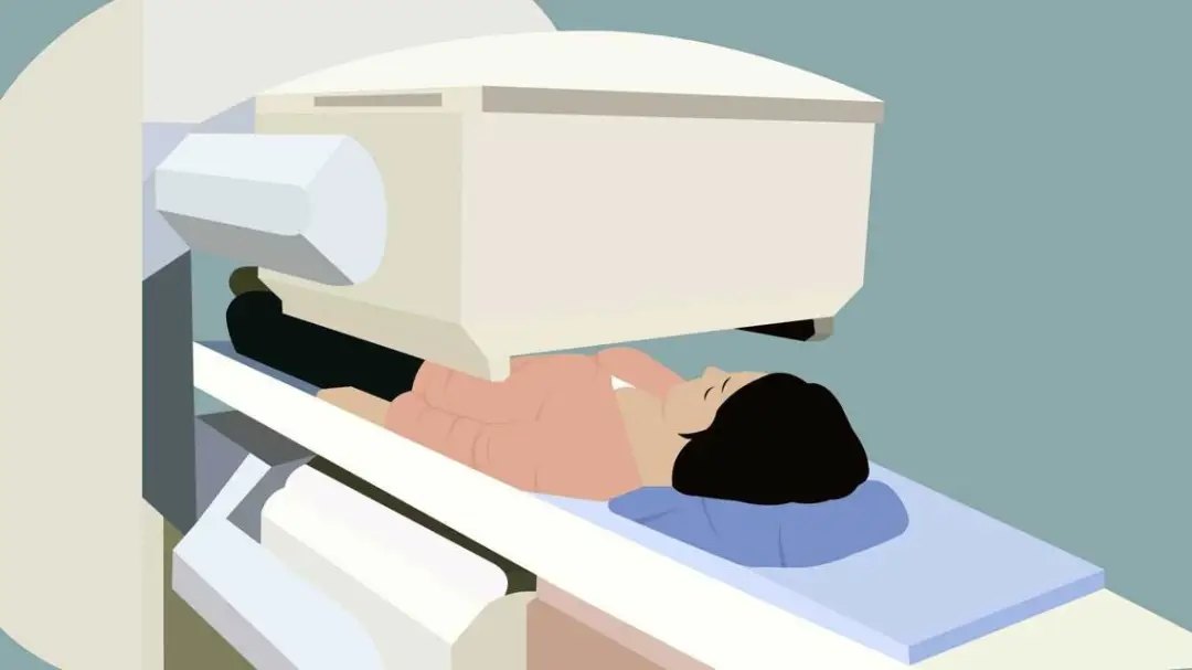 中医治疗晚期肠癌的好方法,贝伐珠单抗治疗晚期肠癌有效果吗