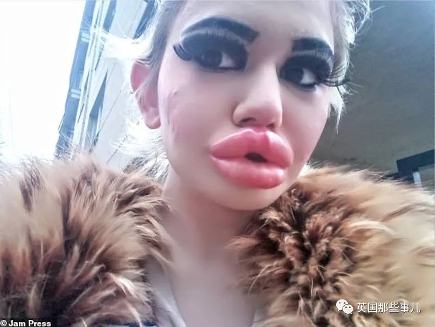 27次手术丰唇,女子疯狂整容100次成芭比疯狂丰唇