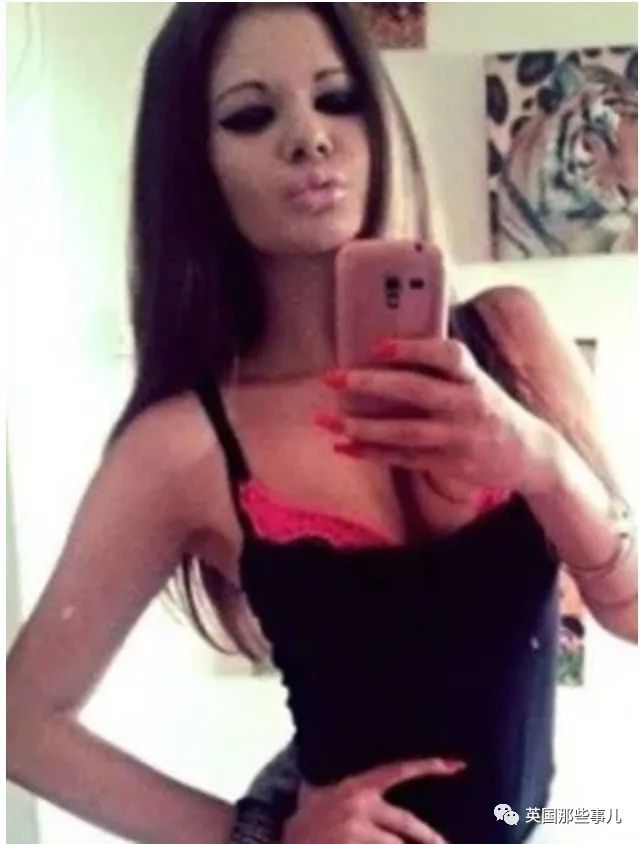 27次手术丰唇,女子疯狂整容100次成芭比疯狂丰唇