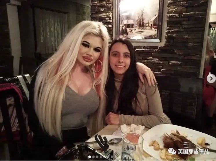 27次手术丰唇,女子疯狂整容100次成芭比疯狂丰唇