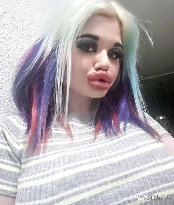 27次手术丰唇,女子疯狂整容100次成芭比疯狂丰唇