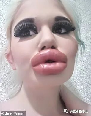 27次手术丰唇,女子疯狂整容100次成芭比疯狂丰唇