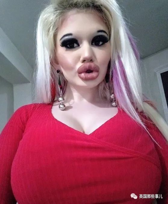 27次手术丰唇,女子疯狂整容100次成芭比疯狂丰唇