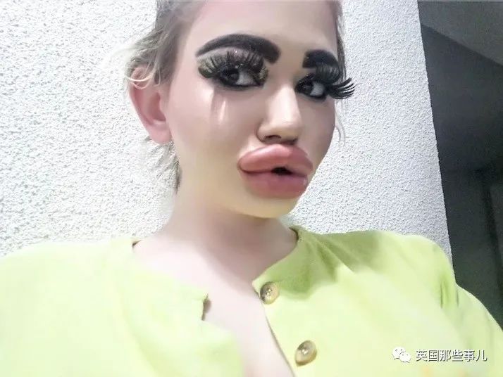 27次手术丰唇,女子疯狂整容100次成芭比疯狂丰唇