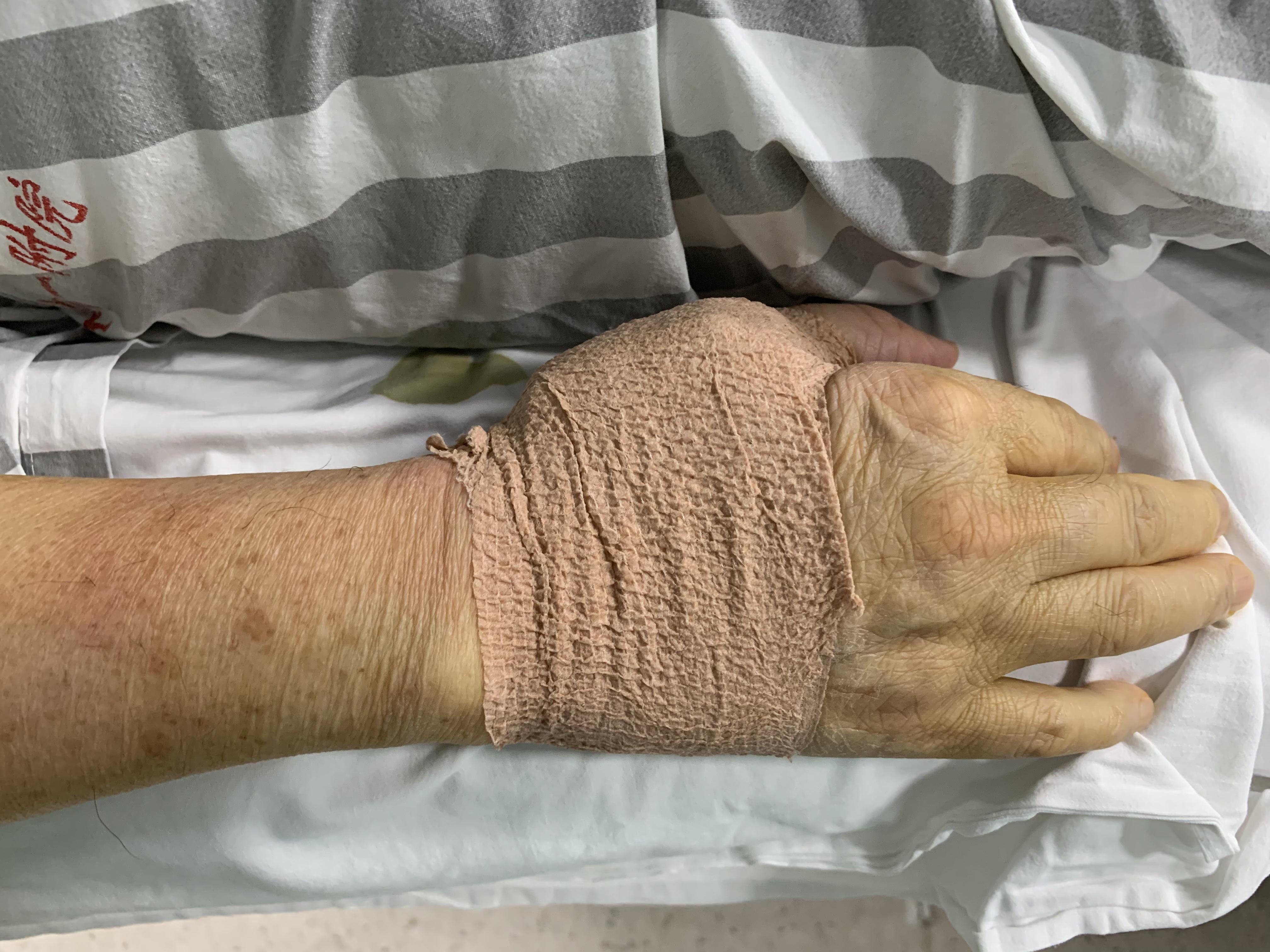 介入手术路径,介入手术临床路径