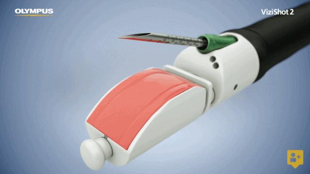 盘点医院各大科室侵入性检查:穿刺、内镜各显神通,小活检标本以“小”见“大”