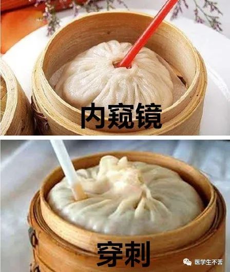 盘点医院各大科室侵入性检查:穿刺、内镜各显神通,小活检标本以“小”见“大”