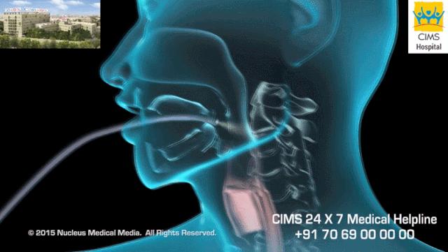 盘点医院各大科室侵入性检查:穿刺、内镜各显神通,小活检标本以“小”见“大”