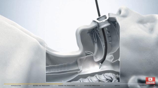 盘点医院各大科室侵入性检查:穿刺、内镜各显神通,小活检标本以“小”见“大”