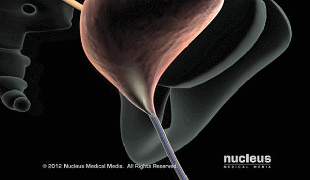 盘点医院各大科室侵入性检查:穿刺、内镜各显神通,小活检标本以“小”见“大”