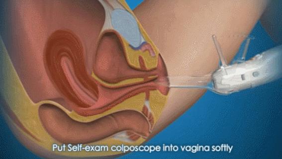 盘点医院各大科室侵入性检查:穿刺、内镜各显神通,小活检标本以“小”见“大”