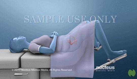 盘点医院各大科室侵入性检查:穿刺、内镜各显神通,小活检标本以“小”见“大”