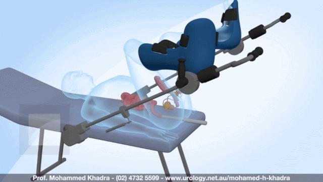 盘点医院各大科室侵入性检查:穿刺、内镜各显神通,小活检标本以“小”见“大”