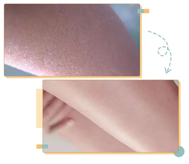 仁和药业沐浴露去螨虫,仁和除螨虫沐浴露