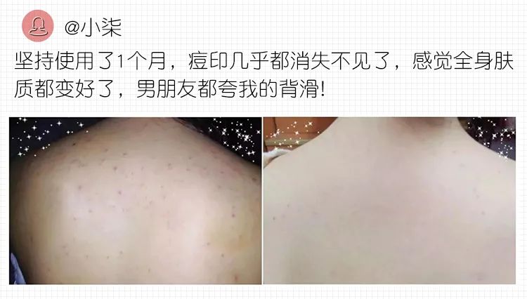 仁和药业沐浴露去螨虫,仁和除螨虫沐浴露