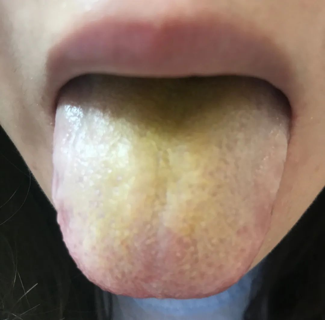 夏天6种事情千万要注意,夏天到了下面八件事要谨记