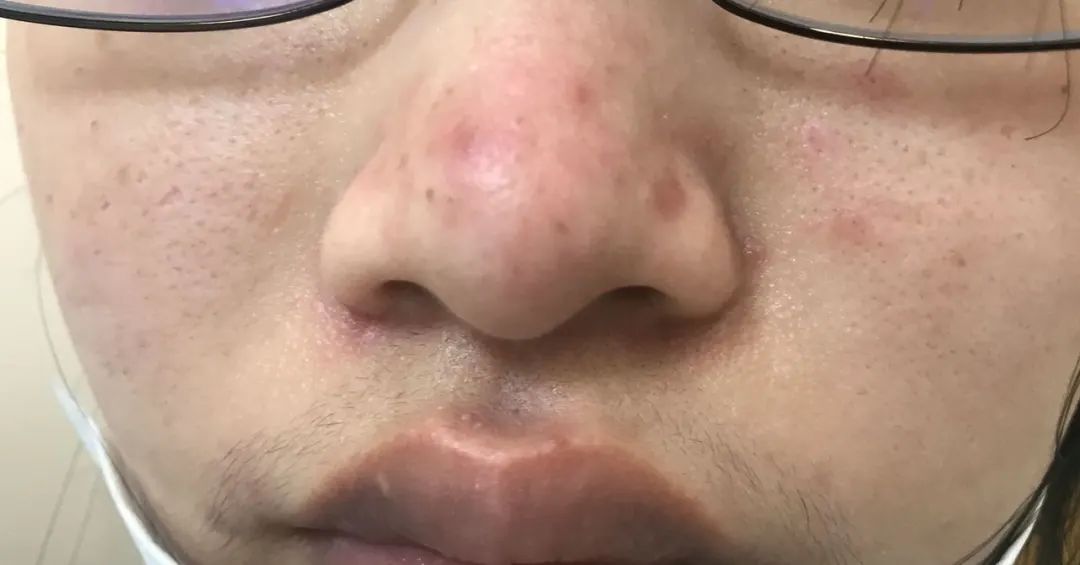 夏天6种事情千万要注意,夏天到了下面八件事要谨记