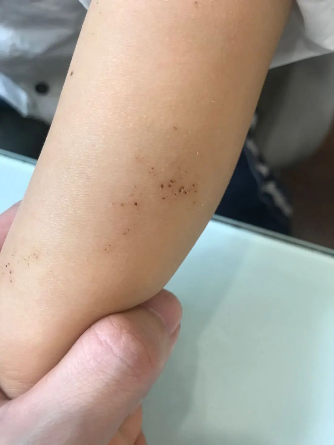 夏天6种事情千万要注意,夏天到了下面八件事要谨记