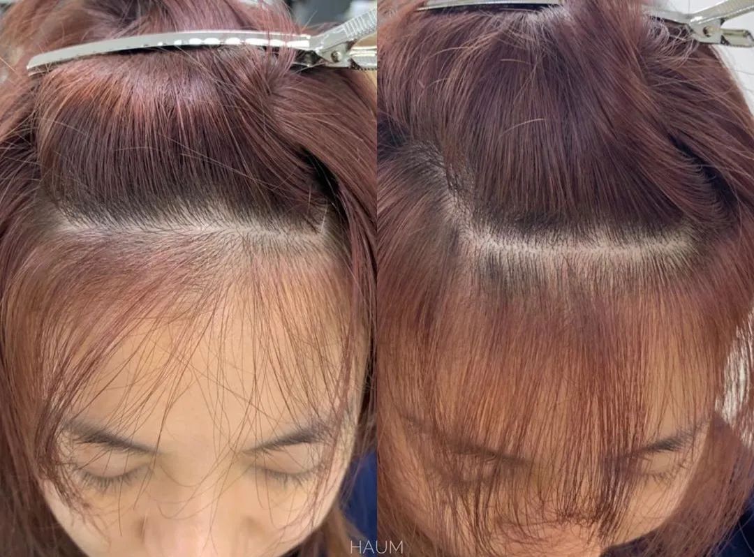 被吹了800遍的刘海打理秘诀来啦,被拉直的刘海怎么恢复