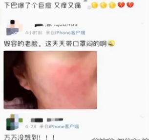 戴口罩会导致痘痘严重吗,长期戴口罩长痘怎么办