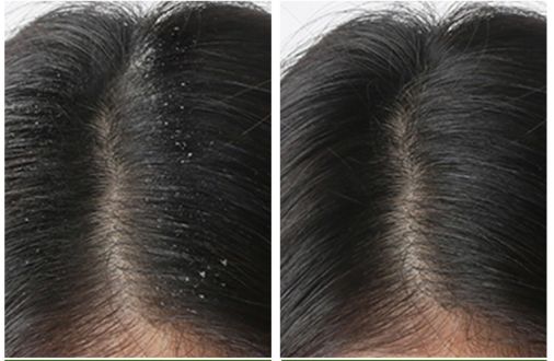 生姜育发洗发水推荐,生姜育发洗发水哪款最有效果