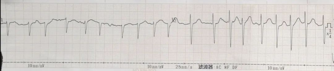 对中医基础理论的感悟,对中医传承的感悟