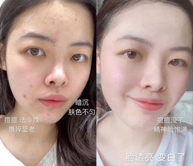 湿气不走，又胖又丑！睡前一贴，逼走体内20多年的湿寒，轻松甩掉失眠、大肚腩