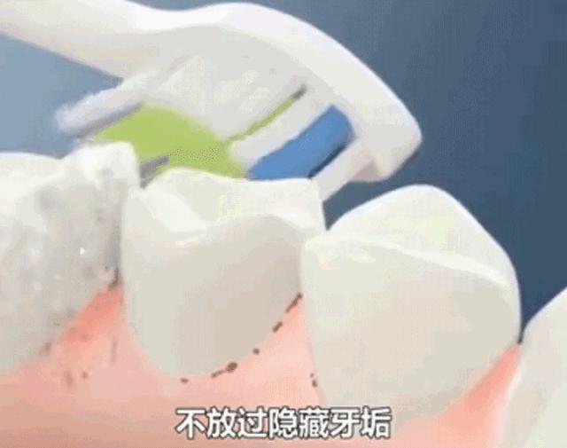 牙齿太黄简单的方法不用花钱,牙齿黄除了洗牙还有什么办法