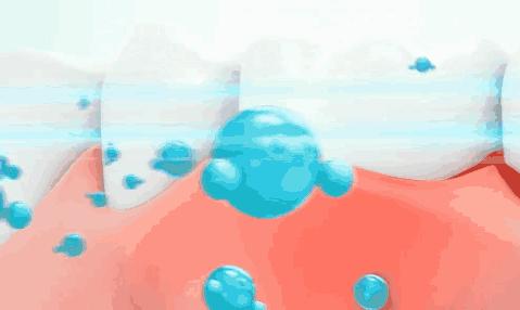 牙龈肿了出血口臭牙黄用什么牙膏,牙龈上火牙膏