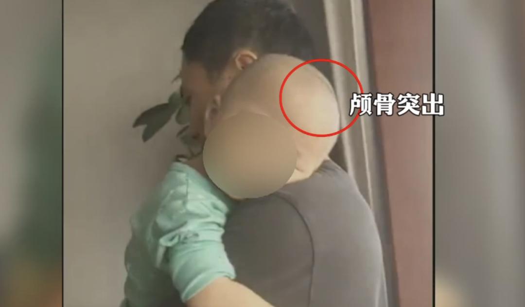 湖南奶粉爆出大头娃娃事件,大头娃娃固体饮料冒充奶粉