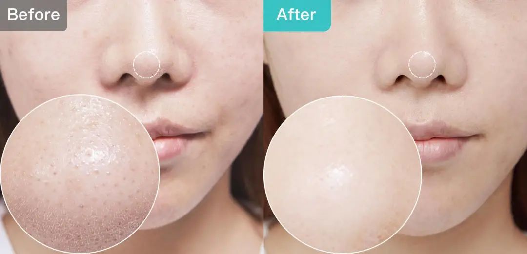 11块钱淡斑体验,1元享受美容养生护理无隐形消费